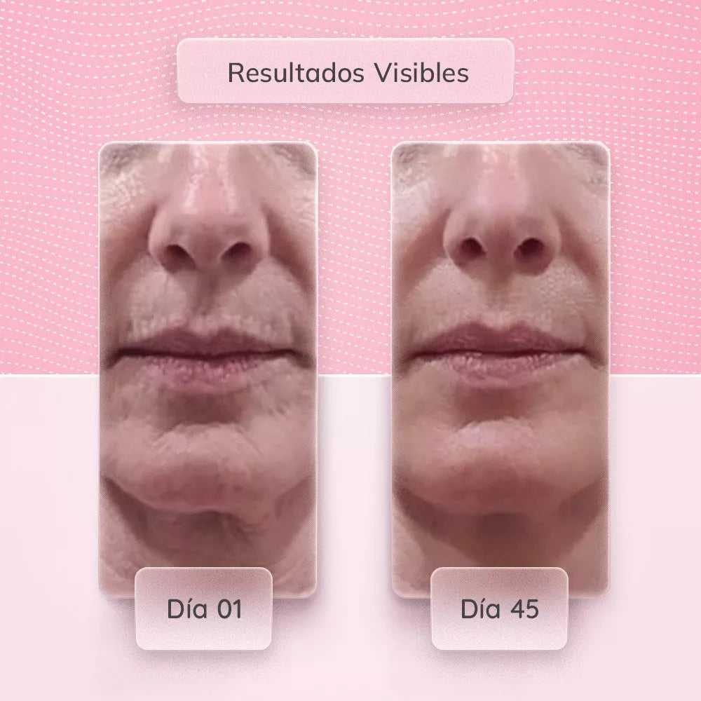 FaceliftPro: Elevador Facial Avanzado para una Belleza Rejuvenecida